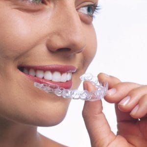 invisalign image